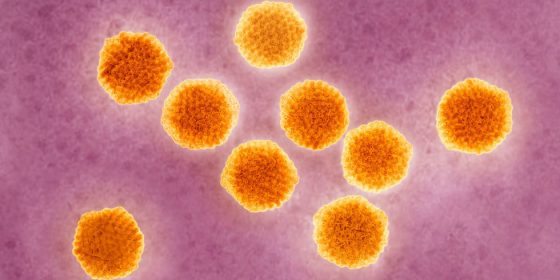 Hepatitis A Outbreak Spreads In Michigan, No Stopping This ‘Regional Epidemic’