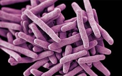 CDC: Deadly Fungal Infection Spreading At “Alarming Rate”