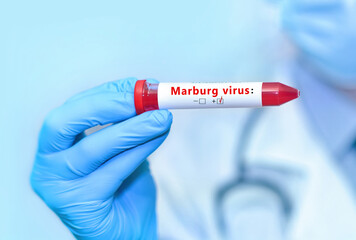 U.S. Issues Travel Alert Because Of Marburg Virus Outbreak In Rwanda U.S. Issues Travel Alert Because Of Marburg Virus Outbreak In Rwanda